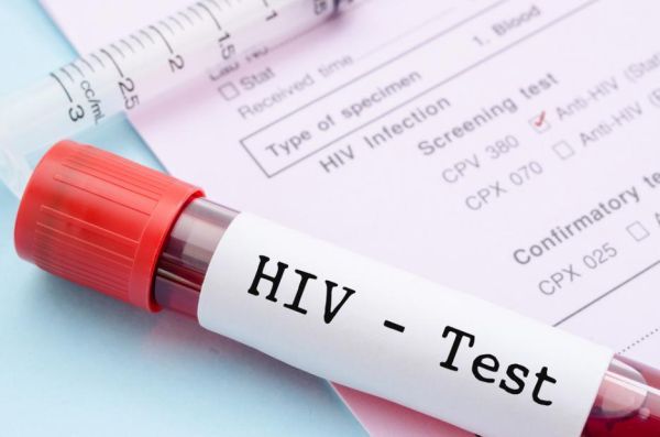 Най-малко три жени са дали положителни проби за вируса ХИВ