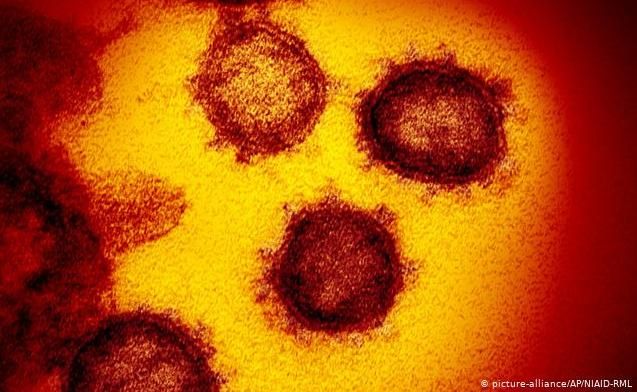 През денонощието са установени 593 нови случая на коронавирус у