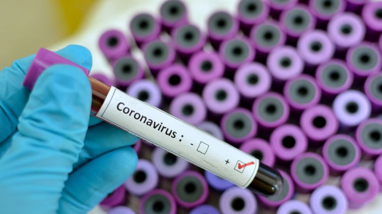 През изминалото денонощие са установени нови 189 заразени с коронавирус,