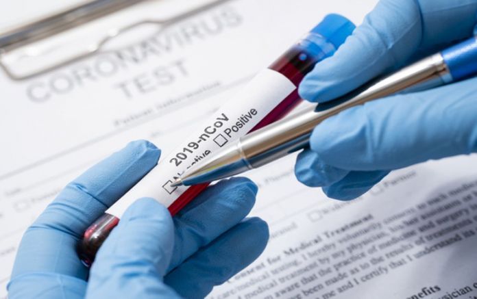 550 са новите случаи на коронавирус у нас за последните