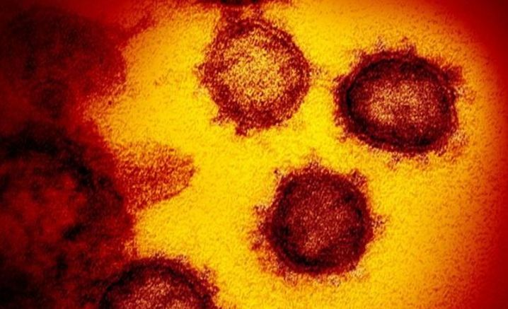 Червени кръвни клетки, засегнати при преболедуване от новия коронавирус, водят