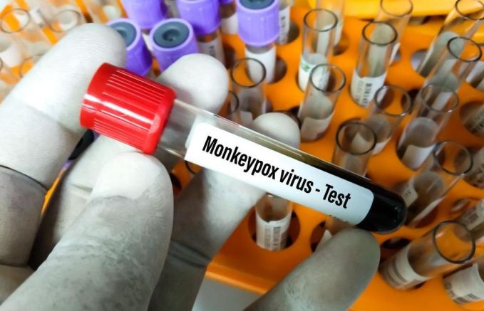 Словения досега са потвърдени шест случая на хора заразени с маймунска