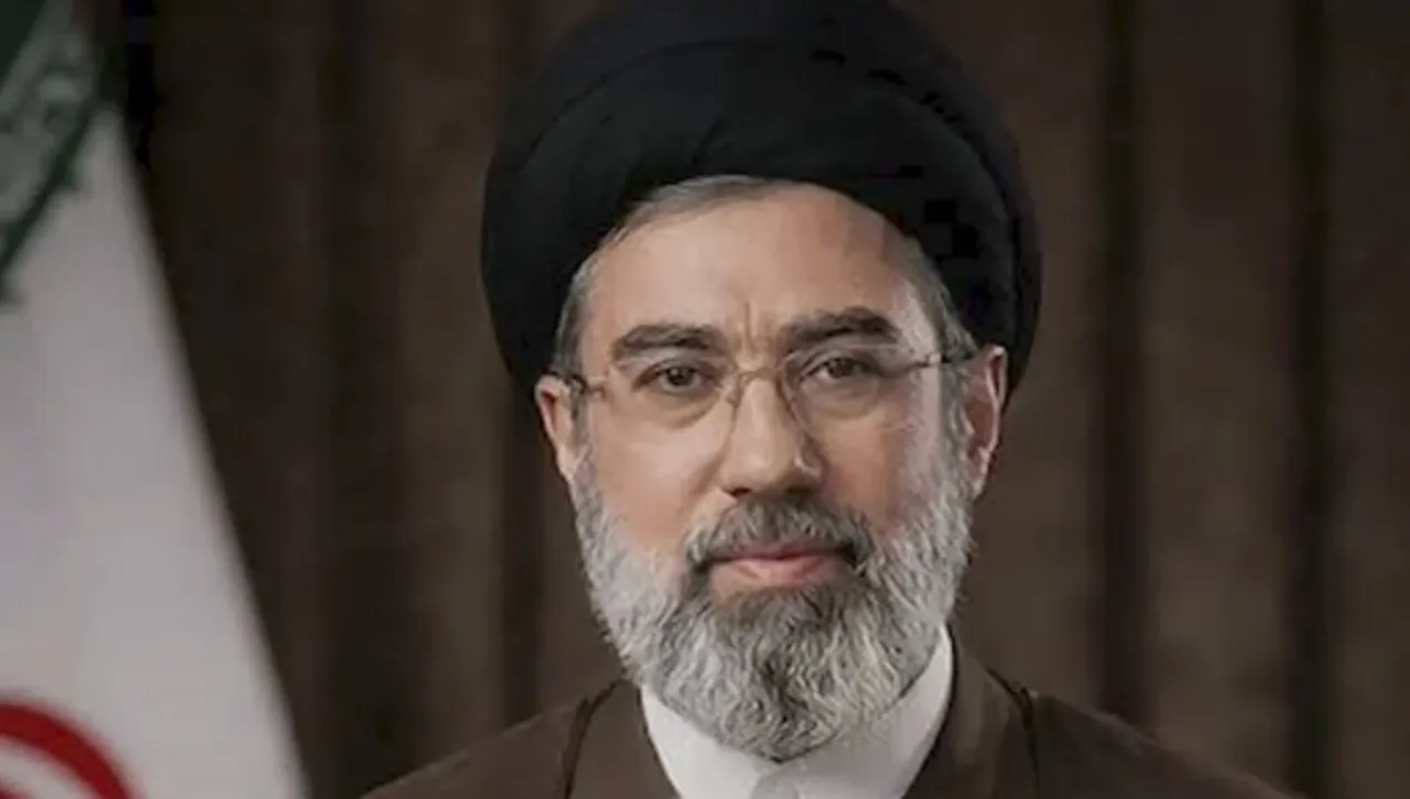 Хаменей-младши е с тежки травми след операция в Русия