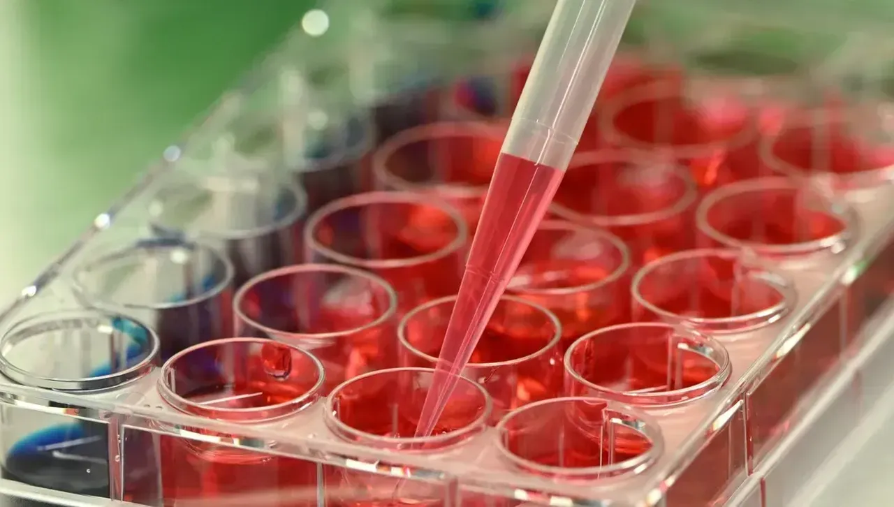 Какви кръвни изследвания да си правим, за да сме в перфектно здраве