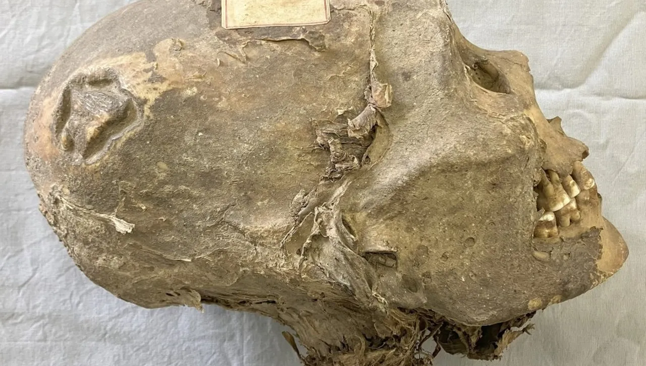 Кой е бил този човек? Нови разкрития за мумия с конусовиден череп и следи от трепанация