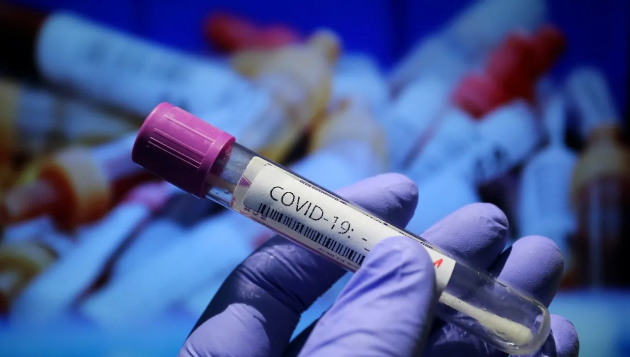 Американски конгресмен свил 5 милиона от ваксините за Covid 19