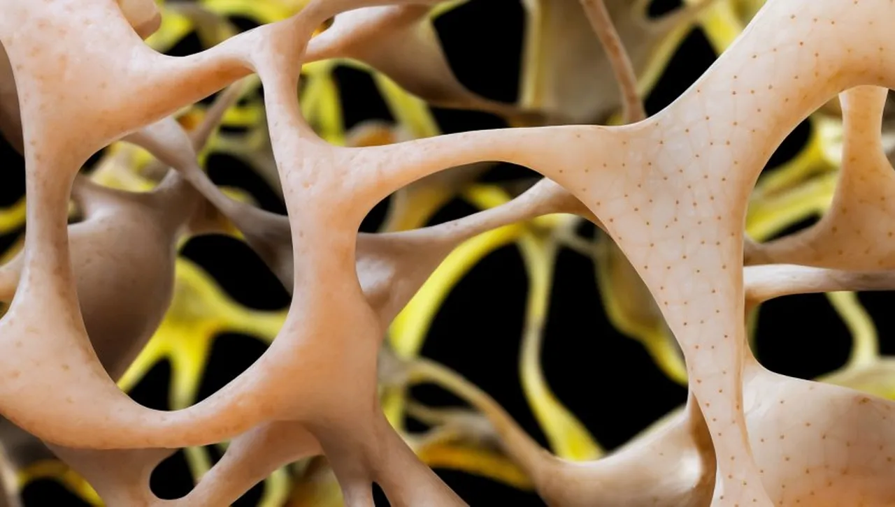 Пробив в борбата с остеопорозата: надежда за по-здравословен живот