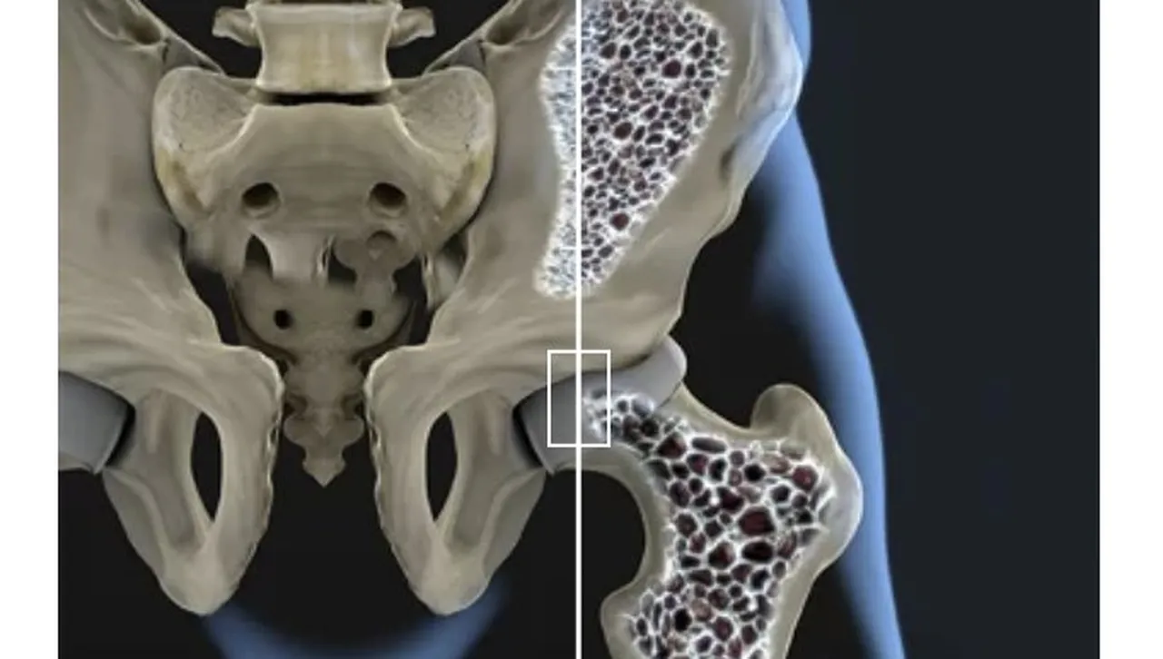 Закуската пази костите: как хранителните навици влияят на остеопорозата