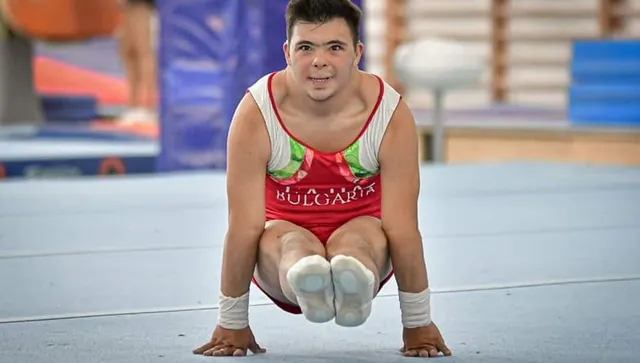 Учени успяха да деактивират гените причиняващи синдрома на Даун