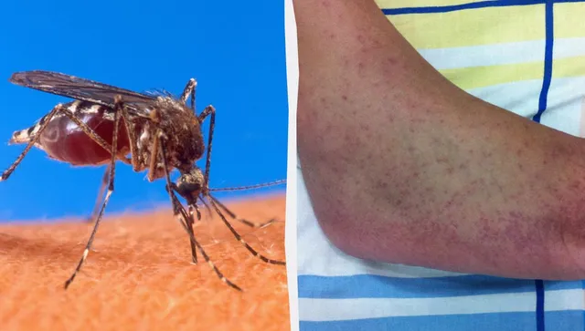 The Guardian: Опасна тропическа инфекция застрашава почти цяла Европа