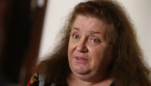 Проф. Александрова: Морбилите са изключително заразно заболяване, може да предизвика "имунна амнезия"